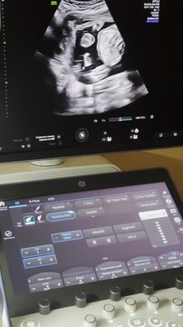 Obstetrician operating an ultrasound machine, examining a fetus on the monitor during a prenatal checkup for a pregnant woman in a modern clinic, focusing on the screen and doctor's hands