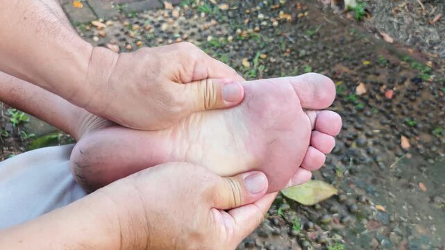 Man experiences pain in his bare feet while sitting on a park bench. Foot pain due to plantar fasciitis and prolonged standing. Health and medical concepts.