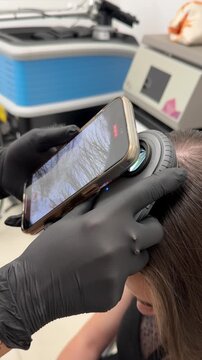 Scalp trichoscopy examination with digital dermatoscope close up, dermatologist diagnostic procedure in clinic