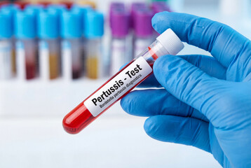 Obraz premium Doctor holding a blood sample for a pertussis test in a pediatric medical laboratory