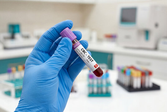 Gloved hand holding a blood sample tube labeled CBC test in a bright clinical laboratory