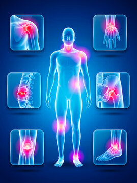 A glowing blue human body highlights painful joints in an anatomical diagram.