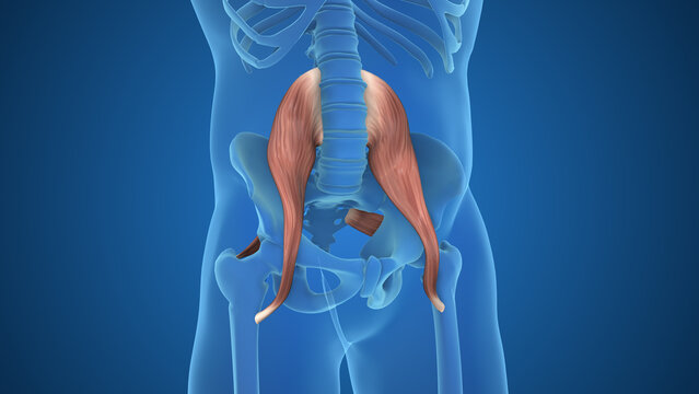 Psoas And Piriformis Causing Sciatica Pain
