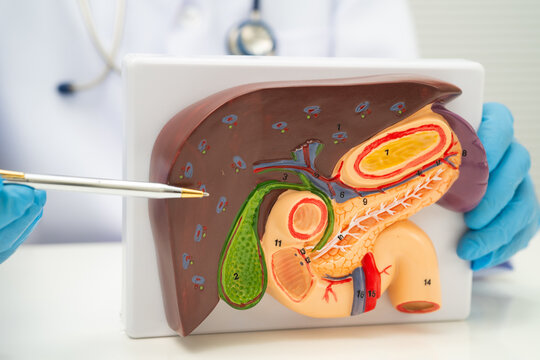 Pancreatitis, pancreatic cancer, Asian doctor with pancreas, gallbladder and bile duct human model.