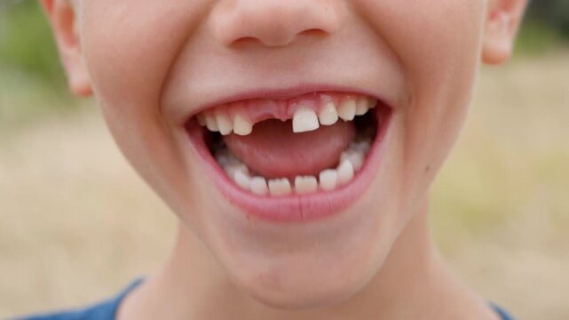 Little boy smiling showing missing front milk tooth. Close up of child mouth with gap in teeth. Natural process of growing up and changing primary teeth to permanent ones.