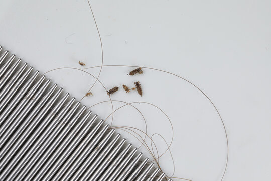 Head lice, nits, and hair on a nit comb