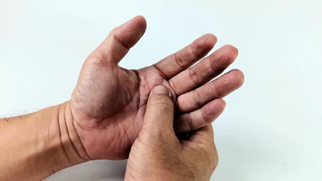 Male with trigger finger symptoms exhibits a middle finger that is difficult to straighten when opening the palm. Man's hands performing a therapeutic self-massage on the palm and fingers