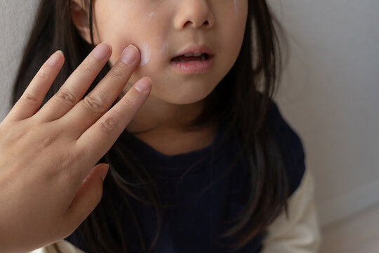 子供の顔に日焼け止めを塗る母親の手