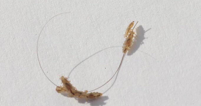 Head lice and nits infestation on a white background