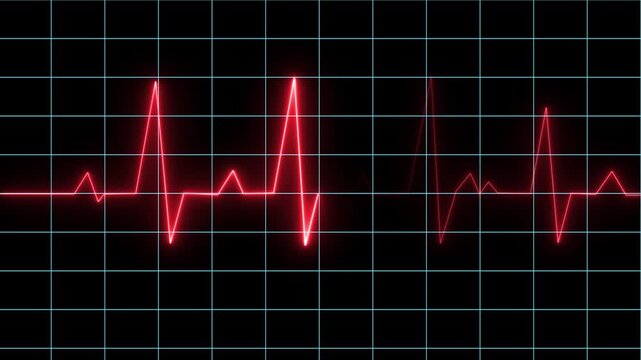 Glowing Red Electrocardiogram Waveform on Dark Grid Background and Neon Red ECG Pulse Line on Dark Grid. 