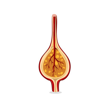 Cross section of a pituitary gland with blood vessels and glandular tissue inside