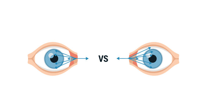 Medical illustration of two human eyes with arrows showing the visual field and how light reflects in left and right directions.
