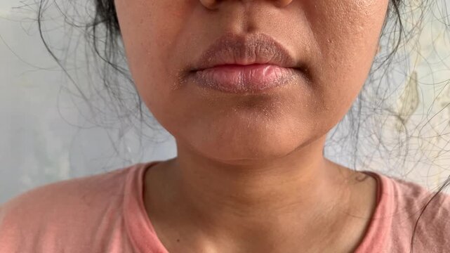 dry itchy skin, eczema in a face around the lip
