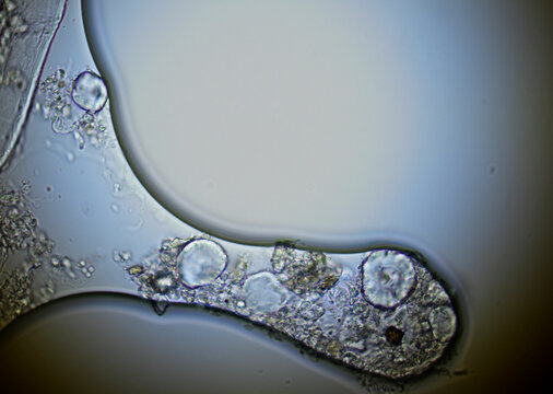 soil microorganisms under a microscope including amoeba, flagellates, nematodes, fungi, bacteria