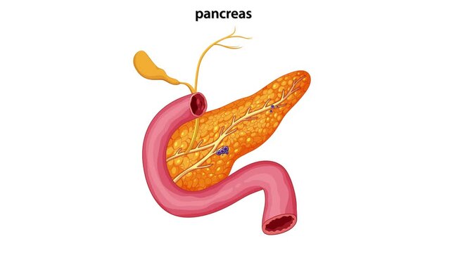 A video animation showing pancreatic cancer metastasizing to lymph nodes and liver, dynamic footage of disease progression.