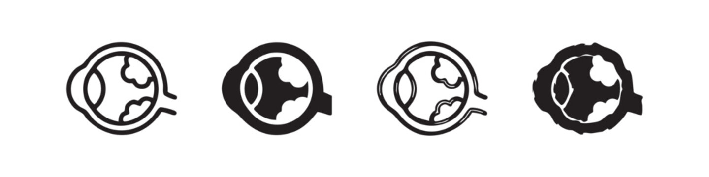 Set of four eyeball icons representing eye conditions: outline, solid, sketch, and distressed