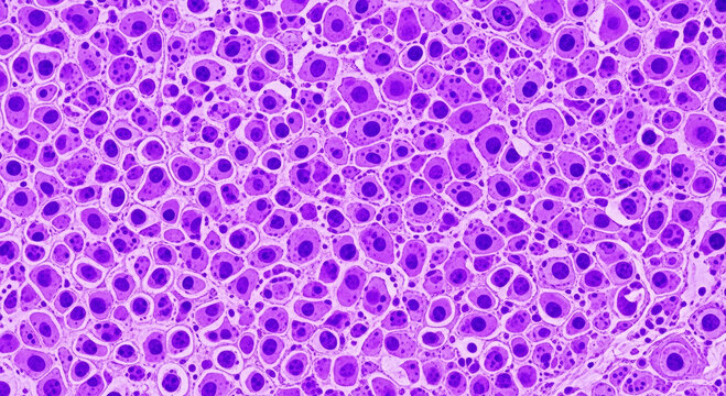 Microscopic view of purple cells with dark nuclei in a tissue sample image