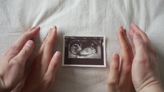 Expecting couple revealing a first trimester ultrasound scan, their hands opening to show the baby's image on a fabric background before joining together in an emotional gesture