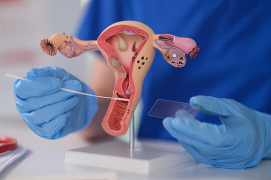 Gloved hands holding swab near uterine model, closeup of technician transferring cervical specimen onto glass slide using sterile