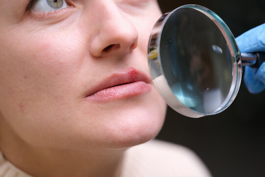 A woman receives careful attention as a professional examines her skin with a magnifying glass for health insights. The warm atmosphere enhances the experience of self-care.