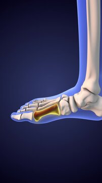 Burning and tingling metatarsals red pain