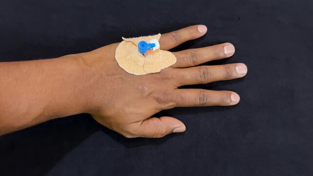 close up of hand with iv cannula inserted and medical dressing against dark background