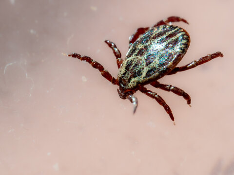 Close-up of a tick on human skin