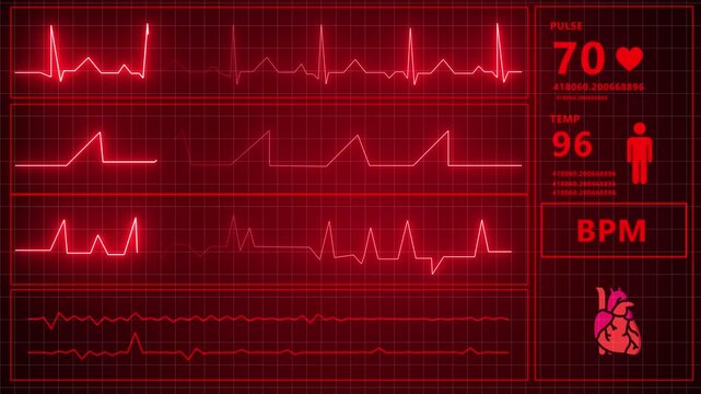 Digital Medical Monitor Screen Displaying Red Heart Rate ECG Waveforms and Vital Signs for Cardiology and Healthcare Technology Concepts