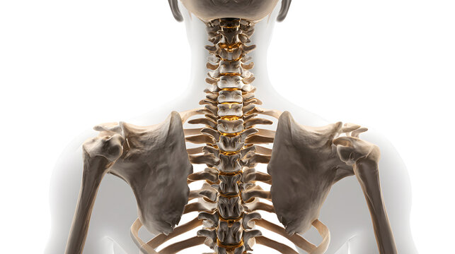 Human skeleton with highlighted spine and ankylosing spondylitis photorealistic medical illustration