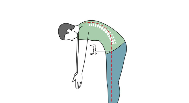 Man bending over, spine curvature measurement, health check, posture assessment