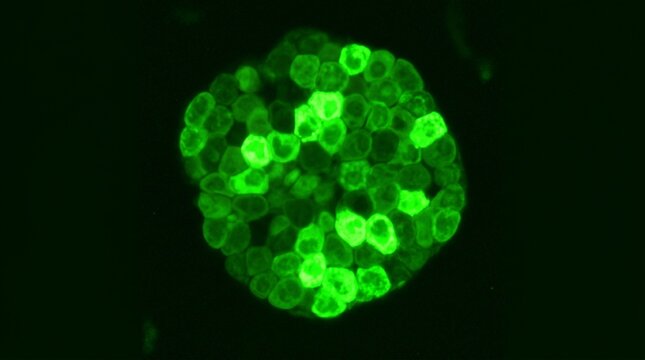 Insulin Secreting Pancreatic Beta Cell Calcium Imaging