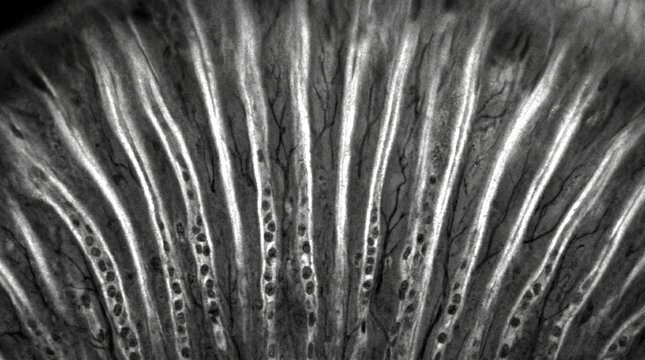 Corneal Limbal Stem Cell Niche Palisades of Vogt