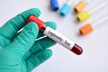 Naklejka premium Laboratory technician holding a blood sample for a legionella bacteria test