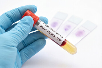 Fototapeta premium Technician holding a blood sample for a heavy metals toxicology test
