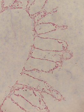 Cross Section of Sycon ciliatum Sponge Showing Radial Canal Sy