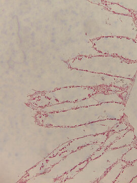 Cross Section of Sycon ciliatum Sponge Showing Radial Canal Sy