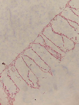 Cross Section of Sycon ciliatum Sponge Showing Radial Canal Sy