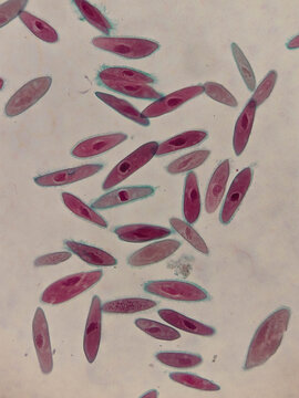 Paramecium Conjugation Stages Showing Nuclear Exchange Under Light Micros