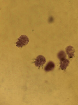 Nereis Three Day Old Trochophore Larvae Showing Early Bristle Develo