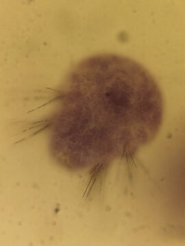 Nereis Three Day Old Trochophore Larvae Showing Early Bristle Develo