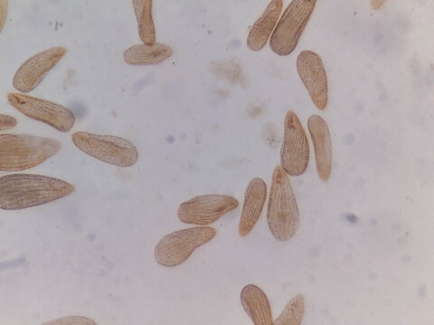 Tetrahymena Silver Stained Preparation Revealing Ciliary Rows and Surface Co