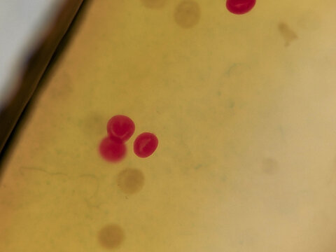 Cerebratulus Gastrula Stage Embryo Showing Early Germ Layer Format