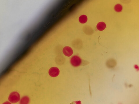 Cerebratulus Gastrula Stage Embryo Showing Early Germ Layer Format