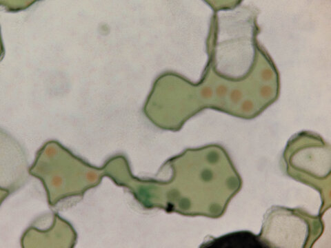 Volvox Colony Showing Daughter Colonies and Chloroplasts Under Light Micros