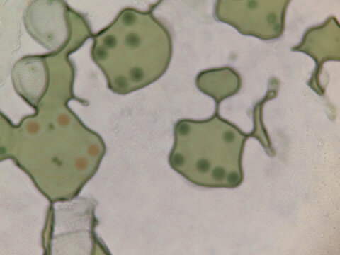 Volvox Colony Showing Daughter Colonies and Chloroplasts Under Light Micros