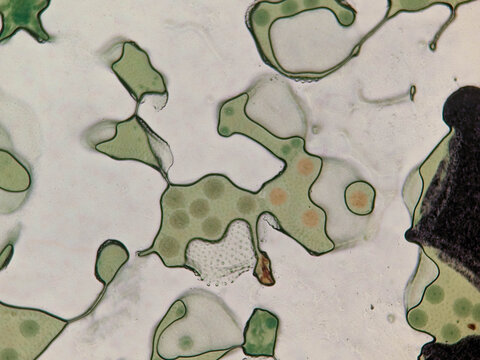 Volvox Colony Showing Daughter Colonies and Chloroplasts Under Light Micros
