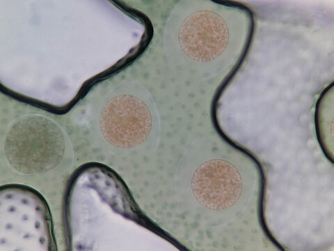 Volvox Colony Showing Daughter Colonies and Chloroplasts Under Light Micros