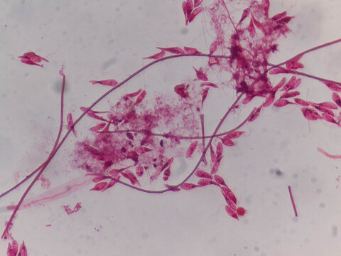 Astasia klebsii Euglenoid Whole Mount Showing Elongated Colorless Cells and Flag