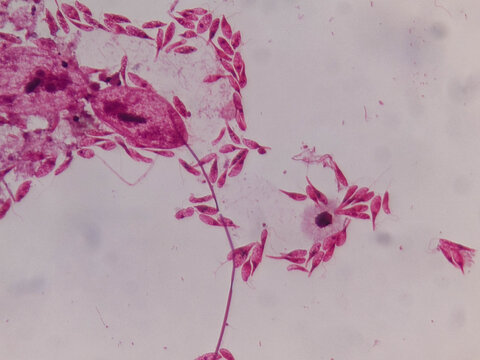 Astasia klebsii Euglenoid Whole Mount Showing Elongated Colorless Cells and Flag