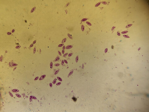 Paramecium caudatum Binary Fission Stages Showing Transverse Cell Division Pr